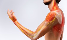 Bệnh viêm đa dây thần kinh nguy hiểm mức nào?