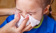 Viêm mũi xoang ở trẻ cần điều trị như thế nào?