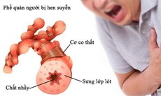 Thuốc điều trị và dự phòng hen phế quản