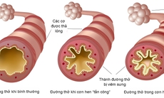 Hen phế quản ác tính và cách dùng thuốc để thoát hiểm