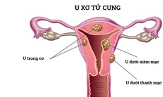 Bụng to bất thường là biểu hiện của bệnh gì, khi nào nên đi khám?