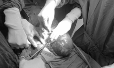 Cứ tưởng béo bụng do uống bia, không ngờ mắc u khổng lồ trong ổ bụng