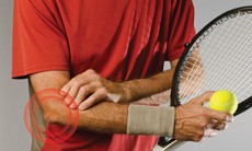 Điều trị và hạn chế hội chứng 'khuỷu tay quần vợt'