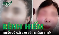 Cô gái đau đớn khủng khiếp do mắc phải căn bệnh hiếm gặp