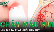 Chảy máu mũi tái phát nhiều năm do các dị dạng mạch hốc mũi