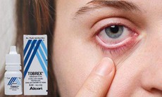 Thuốc đau mắt đỏ tobrex dùng trong trường hợp nào?