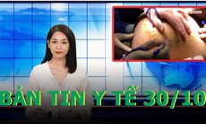 Bản tin y tế 30/10: Cô gái 18 tuổi mang khối u hiểm suốt 7 năm