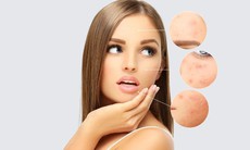 Tác dụng của vitamin B chống lão hóa da và cách bổ sung