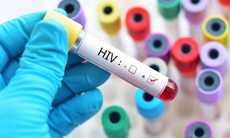 Mỗi năm vẫn phát hiện hơn 10.000 ca nhiễm HIV mới, tăng cường các biện pháp phát hiện phòng ngừa