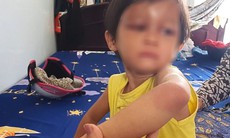 Bắt tạm giam cha nuôi hành hạ bé gái 4 tuổi ở Cà Mau