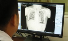 Thêm một công nhân ở Nghệ An tử vong do bụi phổi