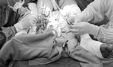 Bệnh viện Đa khoa Bình Dương 'táo bạo' thực hiện kỹ thuật khó, giúp người bệnh giữ lại chân đứt lìa