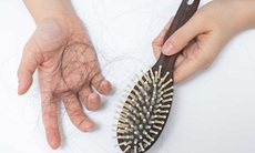 Nguyên nhân rụng tóc và cách kích thích mọc tóc, phục hồi tóc hư tổn