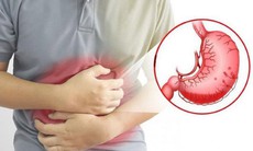 Các bệnh lý thường gặp của đau dạ dày và biện pháp điều trị