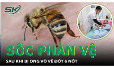 Cấp cứu thành công bệnh nhân sốc phản vệ, suy hô hấp do ong vò vẽ đốt