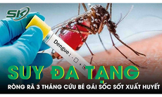 Ròng rã 3 tháng điều trị tích cực cho bé gái sốc sốt xuất huyết nặng, suy đa tạng