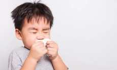 5 biện pháp hỗ trợ chữa viêm mũi xoang ở trẻ hiệu quả