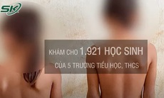 Hơn 1100 học sinh ở Gia Lai bị cong vẹo cột sống
