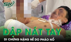 Dập nát 2 bàn tay do pháo nổ