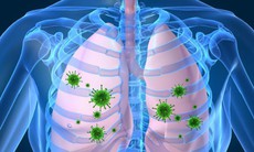 Phòng viêm phổi do cúm cần làm gì?