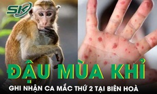 Đồng Nai ghi nhận ca mắc đậu mùa khỉ thứ 2 tại Biên Hòa