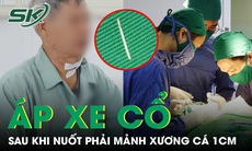 Mảnh xương 1cm 'ẩn nấp' trong món cá khiến cụ ông phải phẫu thuật cấp cứu