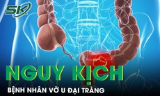 Bụng chướng nhiều, đau dữ dội vào viện phát hiện vỡ u đại tràng