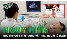 Cứu thai phụ có 1 thai trong và 1 thai ngoài tử cung