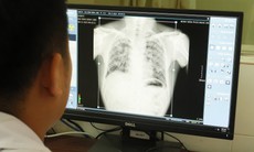 Vụ 6 công nhân ở Nghệ An tử vong do bụi phổi: Công an tỉnh vào cuộc