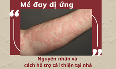 Mề đay dị ứng - Nguyên nhân và cách hỗ trợ cải thiện tại nhà