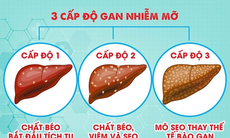 4 món ăn bài thuốc phòng trị gan nhiễm mỡ