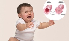 Con húng hắng ho mẹ nghĩ đơn giản, lúc nhập viện đã suy hô hấp 