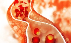 Thử nghiệm thuốc làm giảm cholesterol