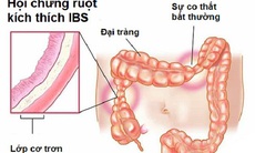 Các thuốc dùng trị hội chứng ruột kích thích kèm táo bón