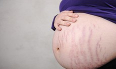 Những bệnh ở da khi mang thai có ảnh hưởng đến thai nhi?