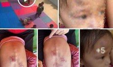 Vụ bé trai 17 tháng tuổi tử vong sau khi đi lớp: Tạm giữ hai cô giáo