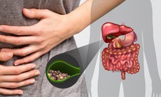 Nhận biết nguyên nhân và điều trị polyp túi mật