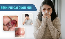 Ngạt mũi liên tục gây khó thở, khó ngủ: nguyên nhân và cách điều trị