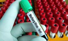Hội đồng chuyên môn họp nghiệm thu Hướng dẫn chẩn đoán và điều trị bệnh sốt xuất huyết Marburg