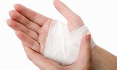 Bong gân cổ tay cần xử trí đúng