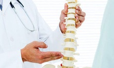 Các thuốc có thể gây hại cho xương khớp cần đặc biệt lưu ý khi dùng