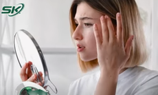 5 loại thực phẩm cần tránh để giữ làn da sạch mụn trong mùa nóng 