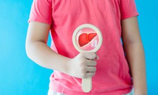 5 ghi nhớ để bảo vệ gan mùa nóng hiệu quả