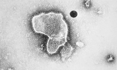 FDA phê chuẩn vaccine đầu tiên ngừa virus hợp bào hô hấp (RSV)