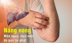 Xua tan nỗi lo mẩn ngứa, mụn nhọt do gan khi sang hè