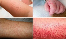 Nhiều tỉnh Nam Trung Bộ có ca mắc sốt xuất huyết, phụ huynh dạy con cách diệt muỗi phòng bệnh