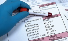 Bạn biết gì về các chỉ số xét nghiệm máu trong sàng lọc chẩn đoán, theo dõi ung thư phổi?