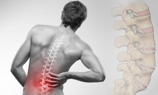 3 động tác tăng cường chức năng cột sống, cải thiện chứng đau lưng
