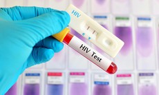 WHO hướng dẫn mới về ức chế HIV và lồng ghép HIV vào chăm sóc sức khỏe ban đầu