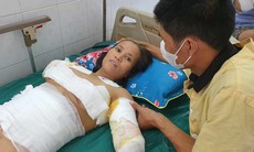 Xót xa gia cảnh người phụ nữ bị bỏng nặng sau khi bất ngờ bị điện giật